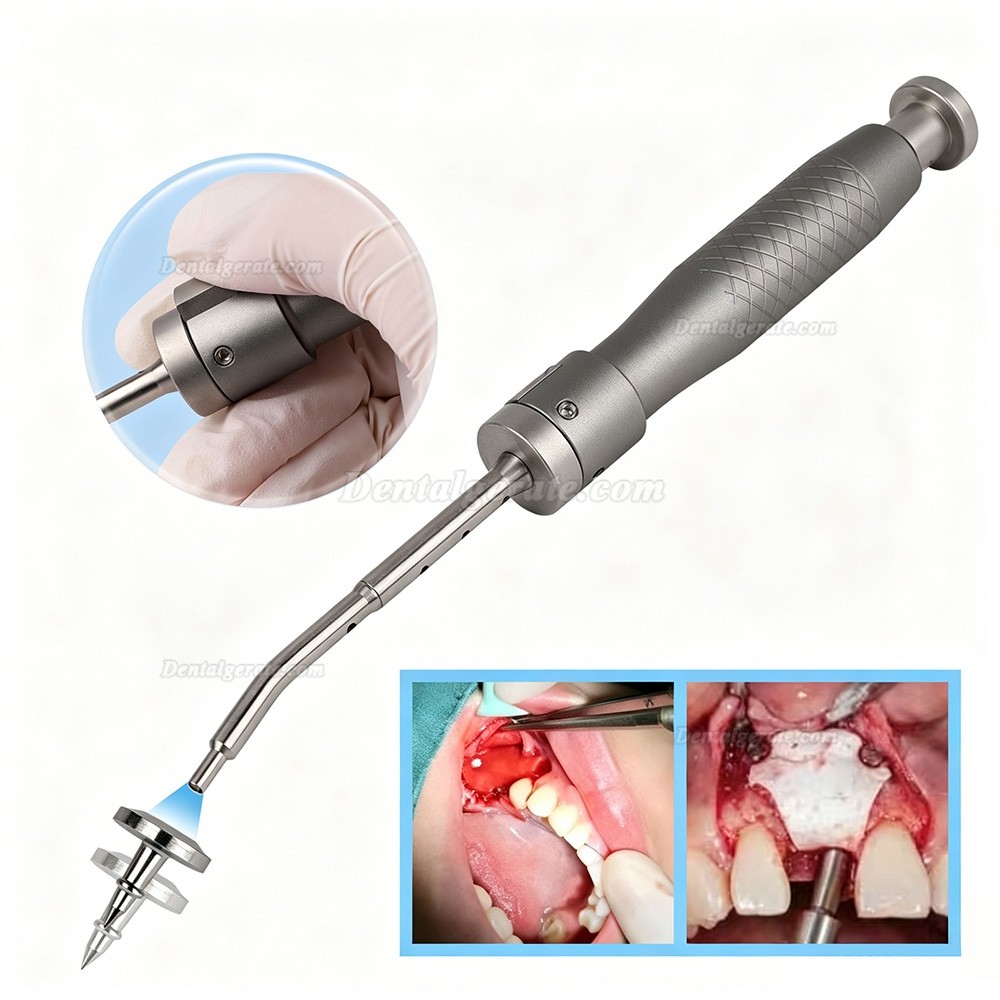 SEGMA Automatisches Mini-Membranfixationssystem, 30 St&uuml;ck Knochenstifte 3mm / 4mm f&uuml;r FGG & GBR